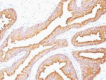 PSA / Prostate Specific Antigen Antibody