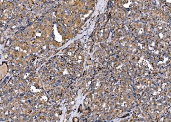 MLXIP Antibody / MLX-interacting protein