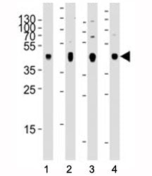 PDK2 Antibody / Pyruvate dehydrogenase kinase 2, 0.4ml