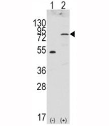 FGFR4 Antibody
