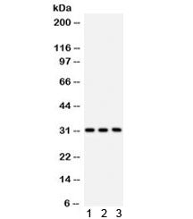 VDAC1 Antibody