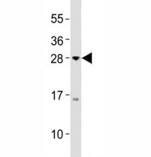 Western blot testing of Olig3 antibody at 1:2000 dilution + MCF-7 lysate; Predicted band size : 29 k