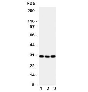 Western blot testing of Cd134 antibody and mouse samples 1: brain; 2: spleen; 3: liver tissue lysate