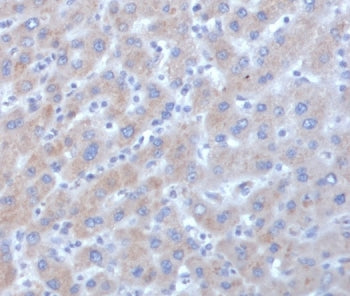 IHC staining of FFPE human liver tissue with Alpha-1-Antichymotrypsin antibody (clone SERPINA3/4185)
