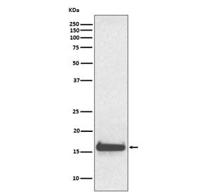 TTR Antibody / Transthyretin / Prealbumin