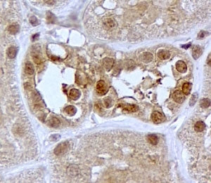 IHC testing of FFPE human kidney with SGK1 antibody at 2ug/ml. HIER: steamed with pH6 citrate buffer