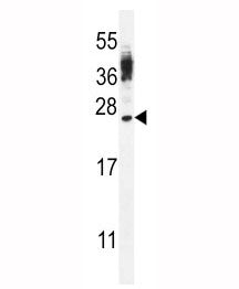 CT45A4 Antibody