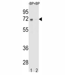 Estrogen Receptor Antibody (alpha)