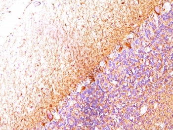 Neurofilament Antibody Cocktail (Heavy + Light)