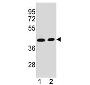 ADA antibody western blot analysis in (1) CEM and (2) Jurkat lysate. Expected/observed molecular wei