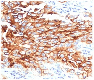 Mesothelin Antibody / MSLN