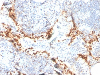 IHC staining of FFPE human lymph node with HAVCR2 antibody (clone TIM3/4024). HIER: boil tissue sect