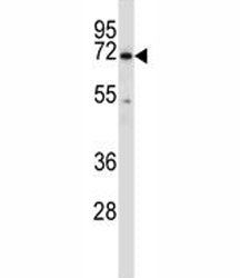 BTK Antibody