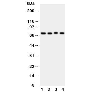 Western blot testing of ABCG2 antibody and Lane 1: rat liver; 2: rat spleen; 3: rat kidney; 4: mouse