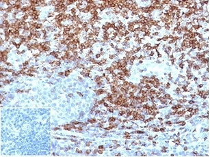 IHC staining of FFPE human tonsil tissue with recombinant CD5 antibody (clone C5/4516R) at 2ug/ml in