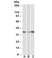 LASP1 Antibody