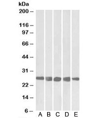 Western blot testing of A) mouse NIH3T3 and human B) HeLa, C) K562, D) MCF7 and E) HepG2 lysates wit