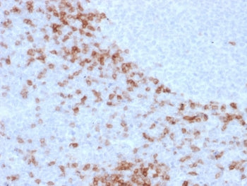 IgD Heavy Chain Antibody