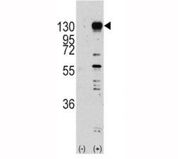 Fibroblast growth factor receptor 1 Antibody (FGFR1)