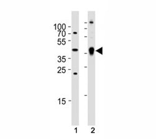 Ada Antibody (Zebrafish)