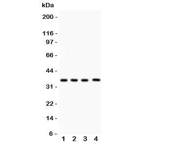 Western blot testing of PBK antibody and Lane 1: rat testis; 2: mouse testis; 3: human placenta; 4: 
