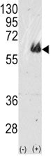 TAU Antibody