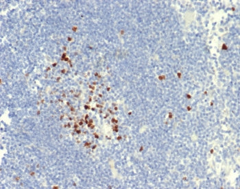 IHC staining of FFPE dog lymph node tissue with Topoisomerase II alpha antibody (clone TOP2A/7169R).
