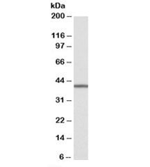 TRIB1 Antibody