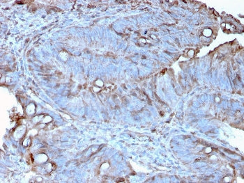 MerTK Antibody