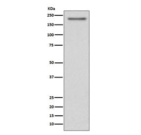 Western blot testing of human SH-SY5Y cell lysate with PDGFRA antibody. Expected molecular weight: 1