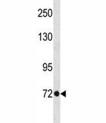 EOMES Antibody (TBR2)