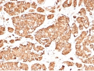 IHC staining of FFPE human pituitary gland tissue with recombinant ACTH antibody (clone rCLIP/3814) 