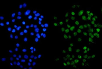 METTL14 Antibody