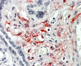 HCP1 Antibody