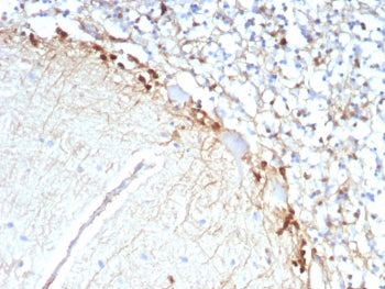 Glutamine Synthetase Antibody / GLUL