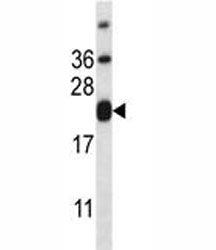 CD3e Antibody