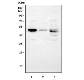 Western blot testing of 1) rat liver, 2) rat lung and 3) mouse liver tissue lysate with LOX antibody