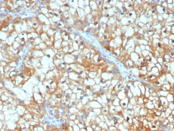 TGFB3 Antibody / TGF beta 3
