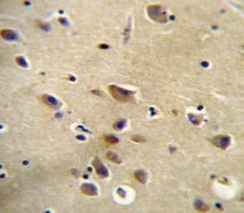 IHC testing of FFPE human brain tissue with Angiotensin II Type 1 Receptor antibody. HIER: steam sec