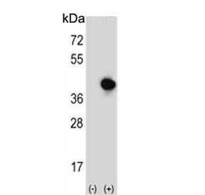 RFC5 Antibody