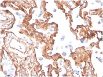 IHC staining of FFPE human lung tissue with SPTAN1 antibody (clone SPTAN1/3505). HIER: boil tissue s