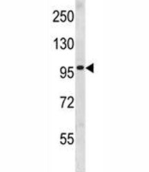 Progesterone Receptor Antibody