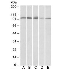 Western blot of human spleen (A), human thymus (B), mouse spleen (C), mouse thymus (D) and rat thymu