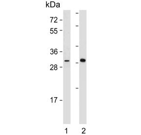 Western blot testing of 1) mouse heart and 2) human skeletal muscle lysate with DIO2 antibody. Predi