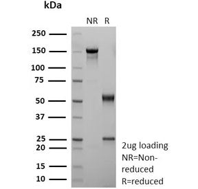 SDS-PAGE analysis of purified, BSA-free recombinant CD36 antibody (clone rGPIIIb/9240) as confirmati