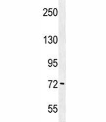 PAK6 Antibody