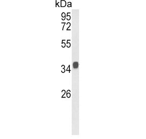 KLF6 Antibody