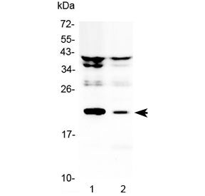 Il-11 Antibody