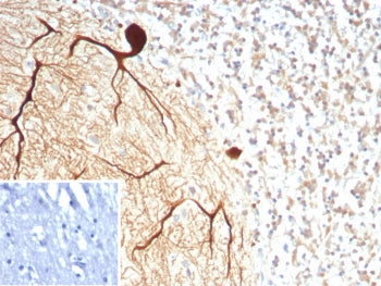IHC staining of FFPE human brain tissue with Carbonic Anhydrase VIII antibody (clone CA8/8605R). Ins