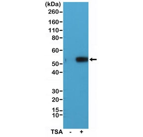Alpha Tubulin Antibody / TUBA4A (Acetyl K40)